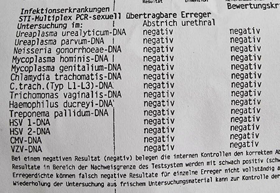 Harnröhrenabstrich Mann: Erfahrungen & Schmerzen